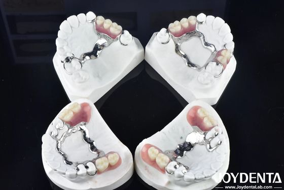 Mua Xây dựng khuôn khổ công nghệ thiết lập răng kết thúc cho cấu trúc miệng ổn định sản xuất trực tuyến