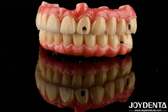 Mua Độ đàn hồi tuyệt vời răng giả acrylic kết thúc với tính chất nhẹ sản xuất trực tuyến