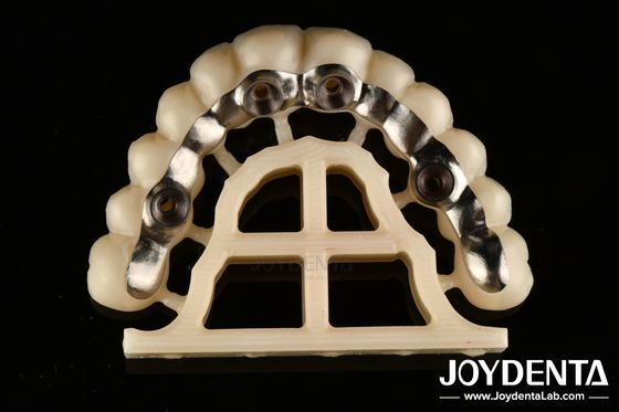 Mua Bạc kết thúc tùy chỉnh Abutments và thanh chính xác phù hợp vít giữ hoặc xi măng giữ sản xuất trực tuyến