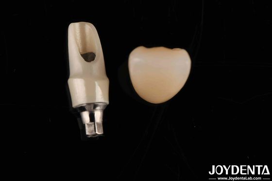 Mua Zirconia Custom Abutments And Bars Phục hồi răng cho cơ thể cá nhân của bệnh nhân sản xuất trực tuyến