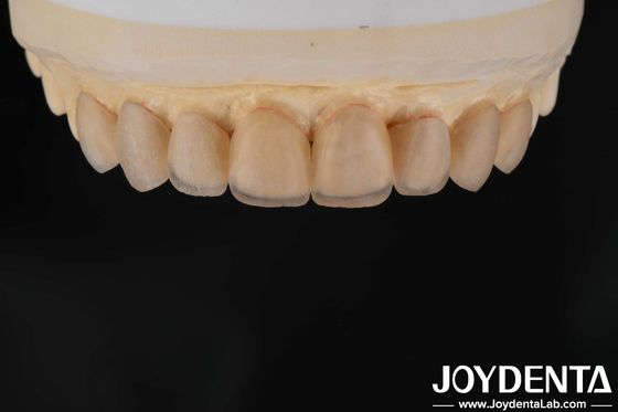 Mua Sự xuất hiện tự nhiên Glass Ceramic Veneers, Dental Clinic Veneers Strong Bond sản xuất trực tuyến