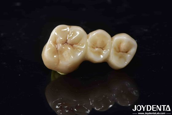Mua Khả năng tương thích sinh học cao Zirconia Full Contour Crown Perfect Fit Độ bền cao sản xuất trực tuyến