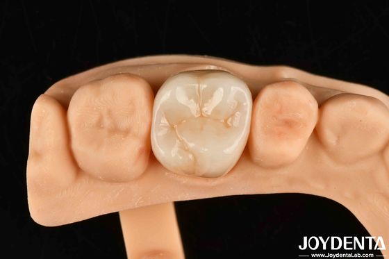 Mua Chống mòn cao nha khoa đầy đủ Zirconia Độ bền cao đầy đủ đường viền Zirconia Bridge sản xuất trực tuyến
