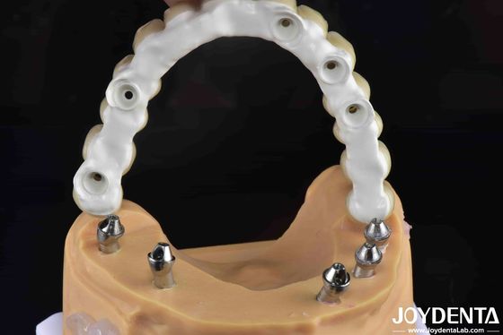 Mua Giải pháp nha khoa chống gãy cây cầu Zirconia Ti-Base Hybrid mạnh mẽ sản xuất trực tuyến