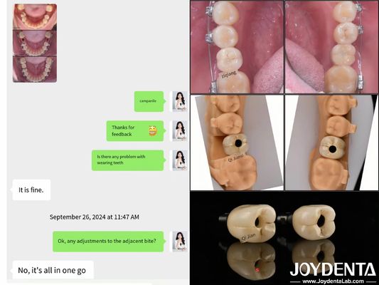 Mua Cấy ghép răng cung đầy đủ lâu dài Cấy ghép nội xương Độ dài 10mm-16mm sản xuất trực tuyến