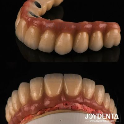 Mua Rụng và xay PFM Vương miện răng, phục hồi răng sứ Vương miện kim loại nóng chảy sản xuất trực tuyến