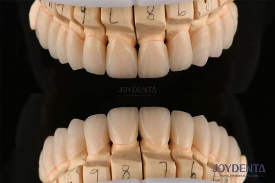 Mua Đèn Zirconia nha khoa lớp đánh bóng Độ dày 0,3-0,5mm Với công nghệ CAD CAM sản xuất trực tuyến
