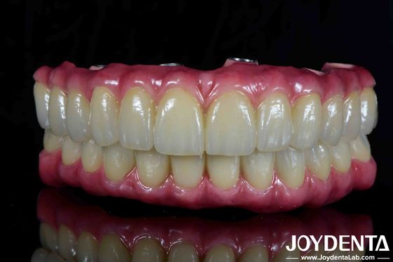 Mua Đường cầu lai Titanium Malong Dental Lightweight thoải mái để phục hồi răng sản xuất trực tuyến