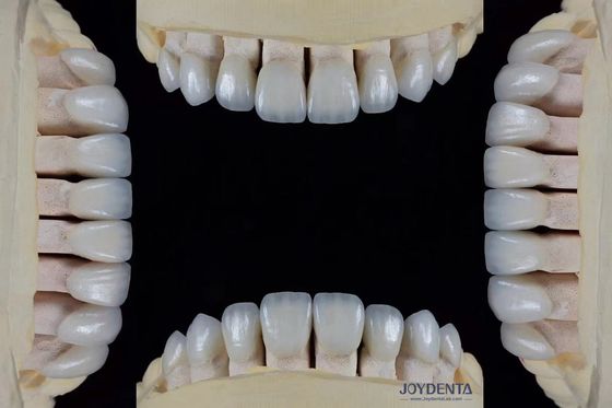 Mua Ultra Thin Feldspathic Veneer 0.3-0.5mm Độ dày chống mờ cao Chọn chính xác sản xuất trực tuyến