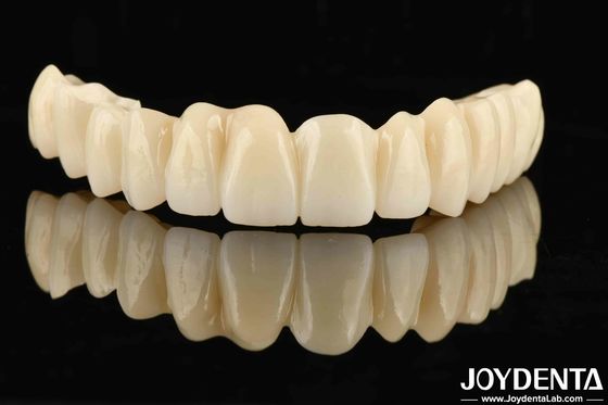 Mua Thiết kế đa lớp PMMA răng nghiêng liền mạch cho chuyển đổi màu tự nhiên sản xuất trực tuyến