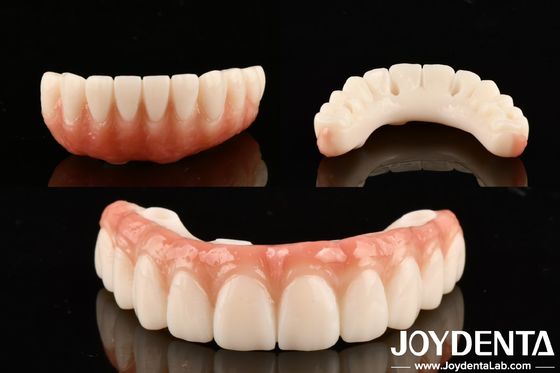 Mua PMMA M75 răng thông minh cao cho phục hồi thẩm mỹ và chống trầy xước sản xuất trực tuyến