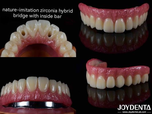 Mua Mùi rõ ràng và nhẹ Ti-Bar Acrylic răng kết thúc cho giải pháp nha khoa sản xuất trực tuyến