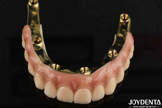 Mua Bộ răng giả Ti-Bar Zirconia Hybrid Bridge với tiêu chuẩn tương thích sinh học cao sản xuất trực tuyến