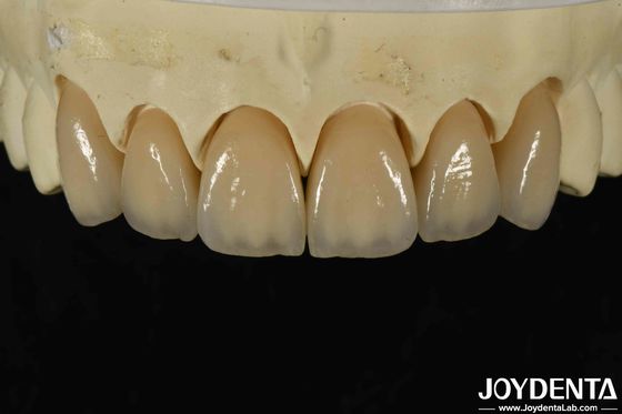 Mua Tương thích sinh học tuyệt vời Zirconia lớp trong thẩm mỹ và mật độ cao 6.0-6.1 G / cm3 sản xuất trực tuyến