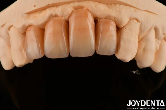 Mua Đẹp lớp Zirconia trắng và bền cho hoàn thiện bề mặt hoàn hảo sản xuất trực tuyến