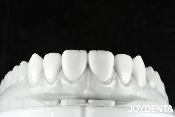 Mua Mái răng màu tự nhiên là giải pháp đa năng để phục hồi một hoặc nhiều răng sản xuất trực tuyến