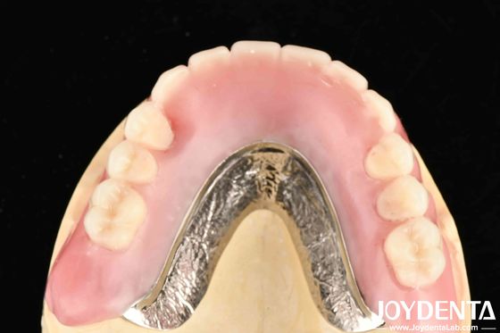 Mua Thắt chặt nối hàng răng xây dựng khung công nghệ thiết lập răng hoàn thiện cho các chuyên gia nha khoa và kết quả chính xác sản xuất trực tuyến