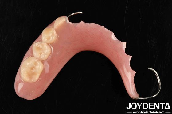 Mua Xây dựng công nghệ cho cấu trúc miệng ổn định khung thiết lập răng kết thúc trong ứng dụng nha khoa sản xuất trực tuyến