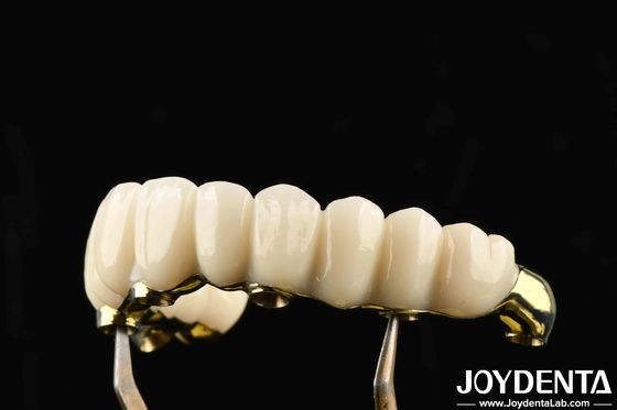 Mua Dễ mặc Ti-Bar Zirconia Hybrid Bridge phục hồi chức năng nhai tương thích với răng và nướu răng tự nhiên sản xuất trực tuyến