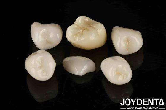 Mua Dễ dàng Cementation Emax Inlay Onlay Sức mạnh trung bình sản xuất trực tuyến