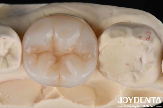 Mua Multilayer Full Zirconia kết hợp tối ưu của sức mạnh và thẩm mỹ cho phục hồi răng sản xuất trực tuyến