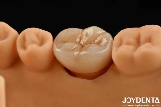 Mua Chiếc Zirconia đa lớp trông tự nhiên để có sức mạnh và độ bền cao sản xuất trực tuyến