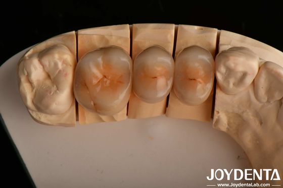 Mua Kháng vỡ cao và thẩm mỹ trông tự nhiên với công nghệ Zirconia đầy đủ nhiều lớp sản xuất trực tuyến