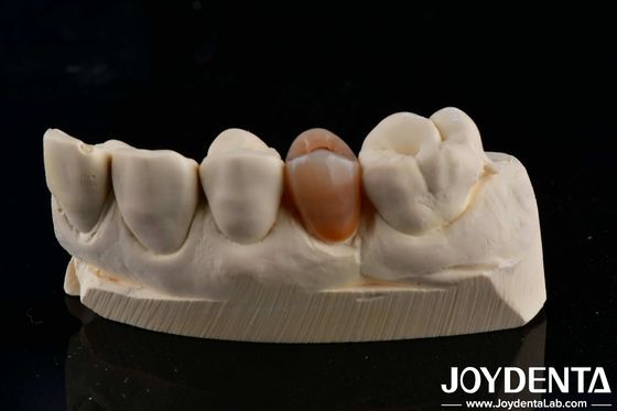 Mua Biocompatible và trông tự nhiên nhiều lớp đầy đủ Zirconia với thẩm mỹ sản xuất trực tuyến