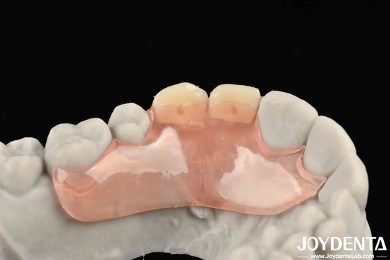 Mua Thiết kế đẹp và hài hòa khung thiết lập răng kết thúc công nghệ tinh vi cho cấu trúc miệng ổn định sản xuất trực tuyến
