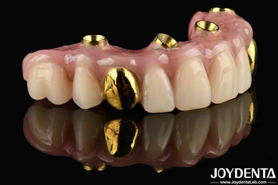 Mua 50ml Dentwre từ Hoa Kỳ Giải pháp cuối cùng của bạn Ti-Bar Acrylic răng kết thúc cho điều trị răng sản xuất trực tuyến
