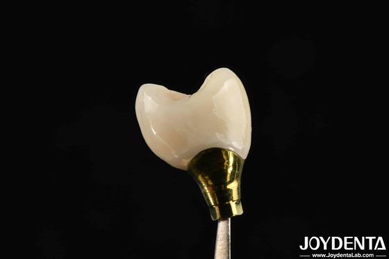 Mua Các kích cỡ khác nhau Implant Crown And Bridge cho các cấy ghép răng mạnh sản xuất trực tuyến