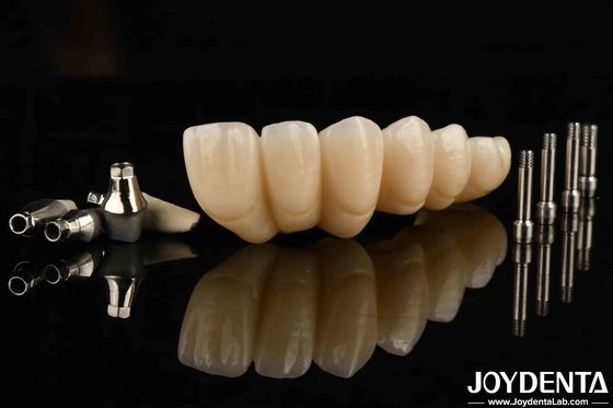 Mua Trải nghiệm thẩm mỹ cuối cùng với vương miện và cây cầu cấy ghép răng đẹp sản xuất trực tuyến