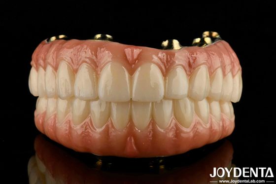 Mua Răng và nướu răng tự nhiên tương thích Ti-Bar Zirconia Hybrid Bridge với khả năng tương thích sinh học cao sản xuất trực tuyến