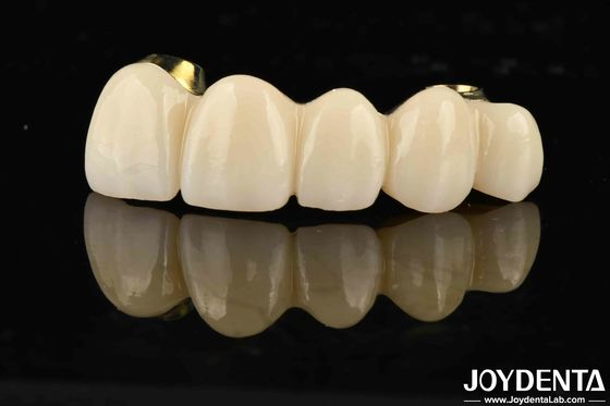 Mua Đường cầu lai Ti-Bar Zirconia sức mạnh tuyệt vời cho răng tự nhiên và sự tương thích nướu răng sản xuất trực tuyến