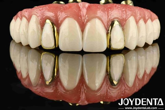 Mua Trải nghiệm độ bền của Titanium Malong cầu lai cho nha khoa áp dụng sản xuất trực tuyến
