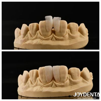 Mua Dễ cài đặt Micro Veneer Giải pháp cuối cùng cho trang trí nội thất Độ dày 0,2mm sản xuất trực tuyến