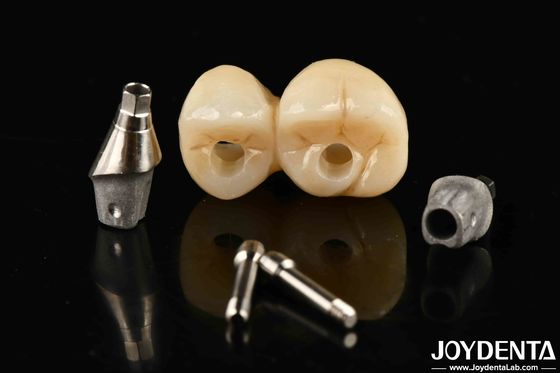 Mua Đồ xăm răng cấy ghép tùy chỉnh được hỗ trợ cầu và vương miện cho thẩm mỹ đặc biệt sản xuất trực tuyến