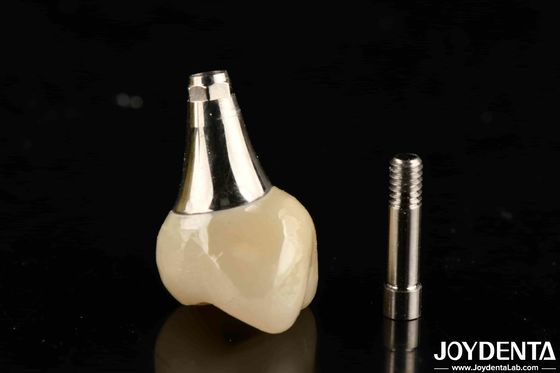 Mua Biocompatible răng cấy ghép vương miện và cầu thẩm mỹ đẹp cho an toàn răng miệng sản xuất trực tuyến