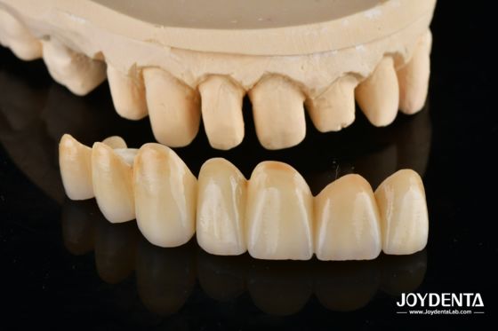 Mua Unveil True Biomimicry: Introducing Our Multi-Layered Zirconia Aesthetic Bridge sản xuất trực tuyến