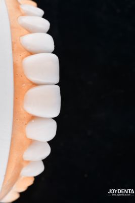 Mua Enhance Case Acceptance & Patient Communication with Our Diagnostic Wax-Up Service sản xuất trực tuyến