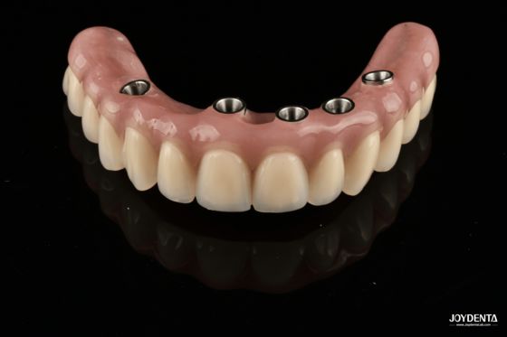 Mua Redefining Full Arch Prosthetics: Unmatched Fit and Function with Our Ti-Base Complete Dentures sản xuất trực tuyến
