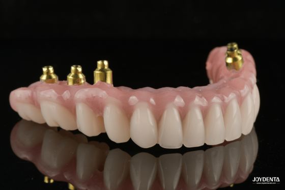 Mua The Strength of Titanium, The Art of Natural Aesthetics. sản xuất trực tuyến