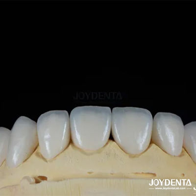 Mua Mảng kết cấu bề mặt bóng Feldspathic Veneer Vỏ kết cấu sứ trông tự nhiên sản xuất trực tuyến