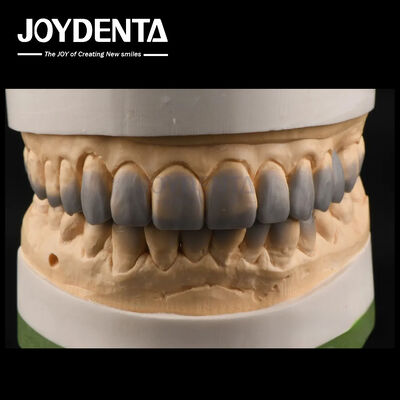 Mua Sử dụng tạm thời Chẩn đoán Wax Ups Dẻo gọn Dental Wax Up Custom sản xuất trực tuyến