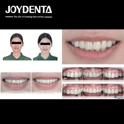 Mua Các sản phẩm phổ biến của Joydentalab: sản xuất trực tuyến