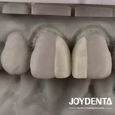 Mua Bề mặt cong chống cháy Micro veneer cho trang trí nội thất sản xuất trực tuyến