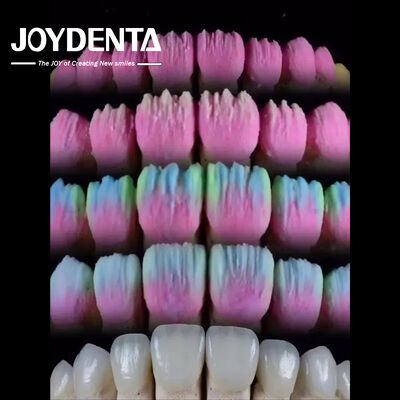 Mua The Joydenta Ceramic Veneer Process sản xuất trực tuyến