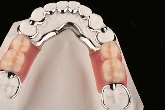 Răng răng một phần Acrylic chống vết bẩn cho sự thoải mái tự nhiên thay thế răng bị thiếu
