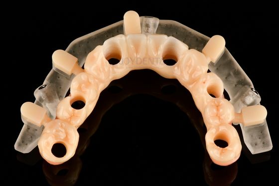 Các mẫu phẫu thuật hướng dẫn in 3D chính xác tùy chỉnh để đặt cấy ghép chính xác