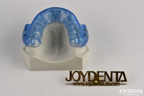Ứng dụng tùy chỉnh có thể điều chỉnh chống ngáy miệng / ngáy bảo vệ miệng Tất cả đêm thoải mái